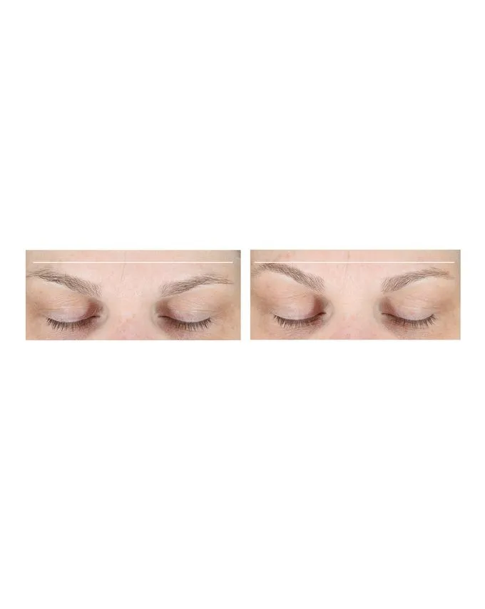 NuFace mini Facial Toning Device (includes 2 oz/59 ml Gel Primer)