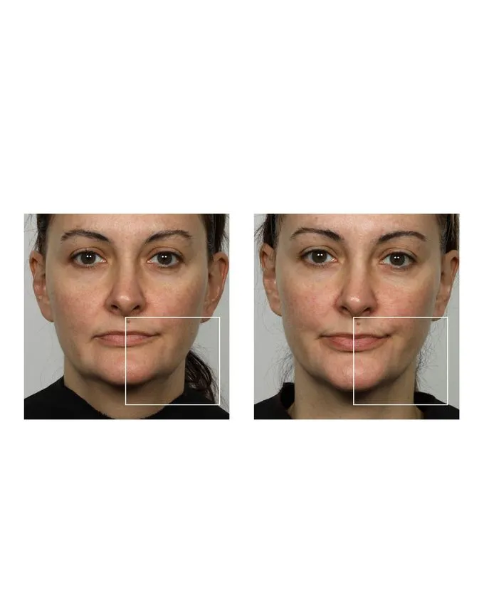 NuFace mini Facial Toning Device (includes 2 oz/59 ml Gel Primer)
