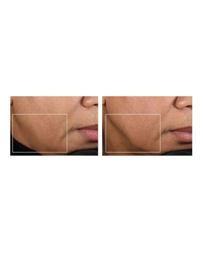 NuFace mini Facial Toning Device (includes 2 oz/59 ml Gel Primer)